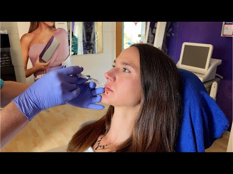 Vorschaubild: Lippen Aufspritzen bei Epicure Köln